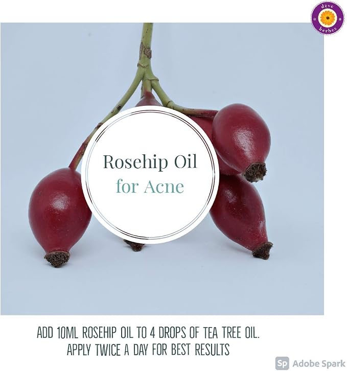 dève herbes Pure Rosehip Oil (Rosa rubiginosa) with Glass Dropper Cold Pressed 5ml (0.16 oz)