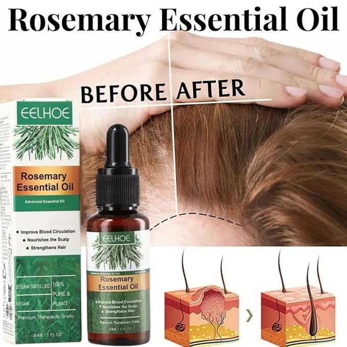 EELHOE Rosemary Hair Essential Oil. 60ml., 1 Fl Oz (Pack of 1), White