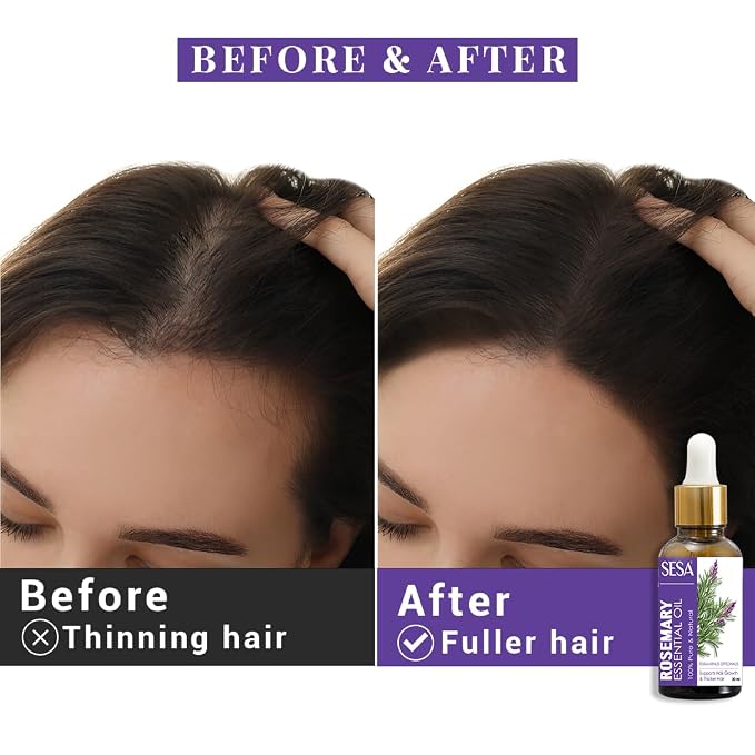 sesa Rosemary Essential Oil For Hair Growth Nourishes Skin Hair Fall Control | 100% Pure & Natural Rosemary Oil, 30 ml | Men and Women