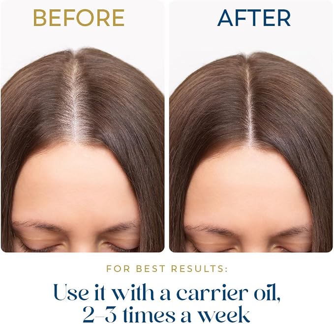Herbsindia Rosemary Essential Oil for Hair - Huge 3.3 Fl Oz - 100% Pure - Premium Grade with Glass Dropper, Undiluted, Non-GMO