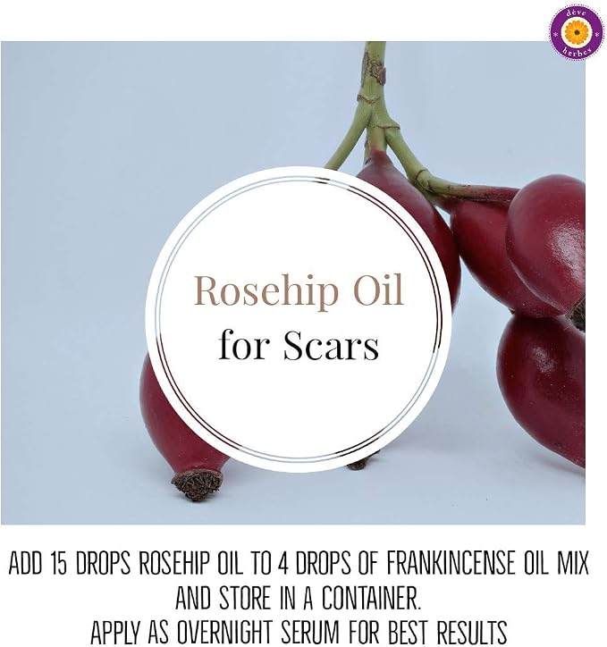 dève herbes Pure Rosehip Oil (Rosa rubiginosa) with Glass Dropper Cold Pressed 5ml (0.16 oz)