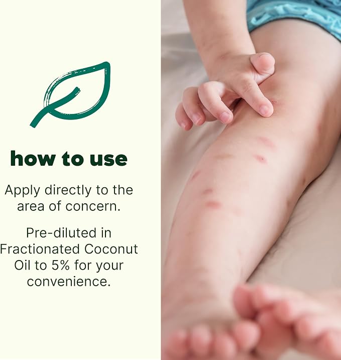 Plant Therapy Kids Itch Away Essential Oil Blend Pre-Diluted Roll-On 10 mL (1/3 oz) 100% Pure Essential Oils to Calm Itchy Skin, Redness, and Irritation