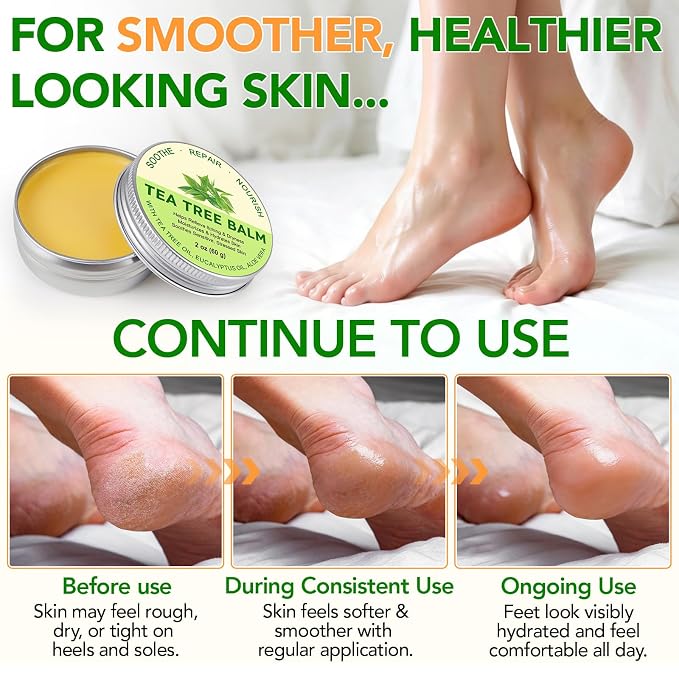 Meifenla Tea Tree Oil Balm,Premium Multi-Plant Complex Formula for Itching & Dry Skin - Moisturizing Care for Hands, Feet, Elbows & Knees | Non-Greasy For All Skin Types