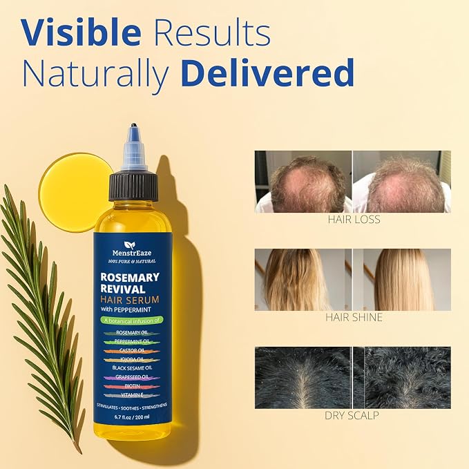 Rosemary, Peppermint & Castor Oil for Hair Growth & Scalp Refresh (6.7 fl oz), Infused with Biotin, Black Sesame, Grapeseed, Jojoba, & Vitamin E Oils for Itchy Scalp, Refreshing & Hydration