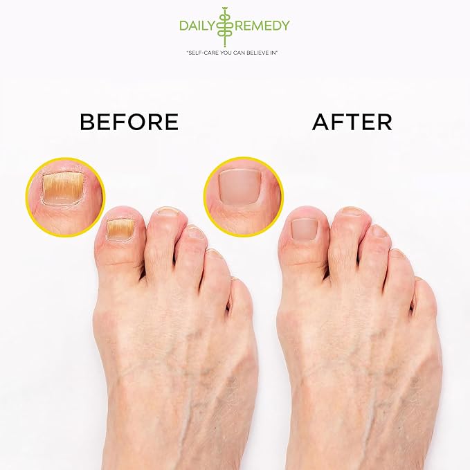 Citrus Detox Foot Soak with Epsom Salt - for Foot Callus, Immune Boost, Damaged Toenail, Athletes Foot, Pedicure and Soothes Tired Feet - Made in USA