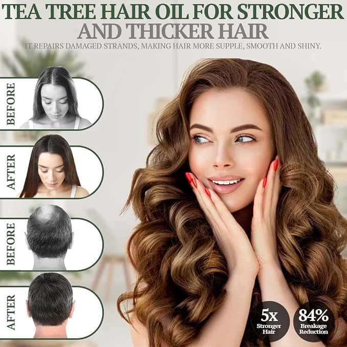 Fiora Naturals Tea Tree Oil for Hair and Scalp - with Jojoba, Grape Seed & Castor Oils - Helps Hair Growth, Soothes Itchy Scalp & Fights Dandruff - Moisturizes and adds Shine - 4 fl oz
