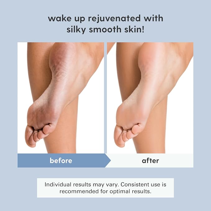 Magnesium Oil Spray for Sore Muscles, Feet, Joints and Leg Cramps, Supports Restful Sleep, Relaxation and Post-Workout Recovery, Suitable for Sensitive Skin, 12 fl oz by M3