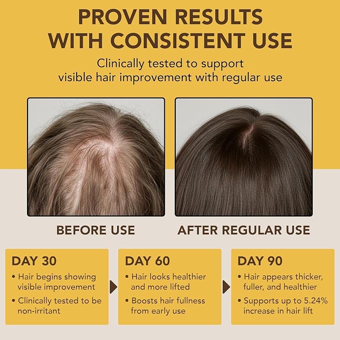 Botanic Hearth Batana Oil for Hair Growth & Hair Treatment Oils 4 Fl Oz | Dr Sebi Inspired, 100% Raw & Pure Batana Oil | Scalp & Hair Treatment for Thickness & Strength | All Hair Types