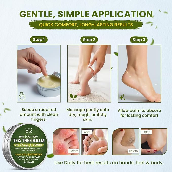 VITAL AFFAIR Tea Tree Oil Balm – Soothing Care for Rashes, Athlete’s Foot, Jock Itch, Bug Bites, Folliculitis, Cracked Feet, Dry, Flaky, Irritated Skin – For All Ages & Sensitive Skin - 4 oz