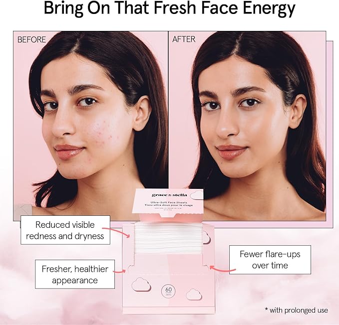 grace & stella Face Towels Disposable - Travel Essentials - Ultra-Soft & Absorbent Face Wipes Towelettes - XL Facial Towels for Cleansing & Makeup Removal - Lint-Free Facial Tissue - Vegan (60 Count)