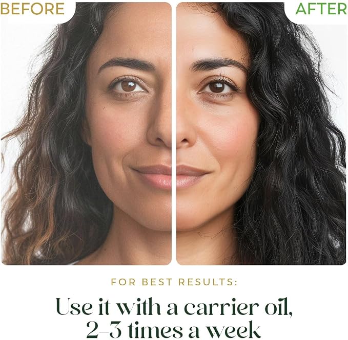 HerbsIndia Tea Tree Essential Oil for Skin - Huge 3.3 Fl Oz - 100% Pure - Premium Grade with Glass Dropper, Undiluted, Non-GMO