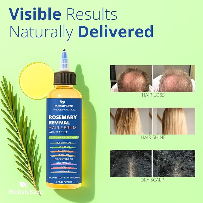 Rosemary, Tea Tree, & Castor Oil for Hair Growth & Dandruff Relief (6.7 fl oz), Infused with Biotin, Black Sesame, Grapeseed, Jojoba, & Vitamin E Oils for Dry, Itchy Scalp, Thickening & Hydration