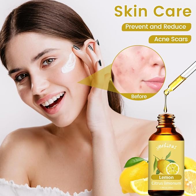 yethious Lemon Essential Oil Lemon Essential Oill for Diffuser, Perfume, Body, Skin, Hair, Candle Soap Making Lemon Fragrance Oil 100ML
