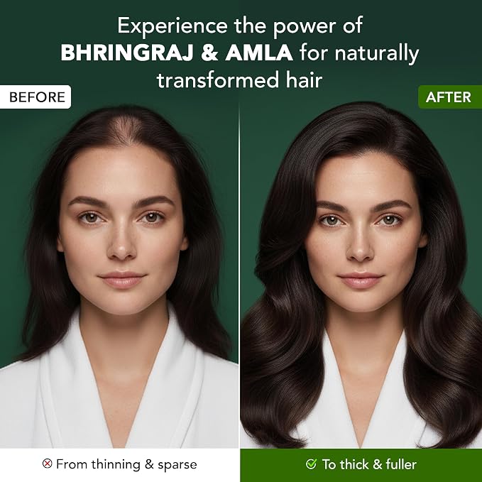 Botanic Hearth Bhringraj & Amla Hair Oil | Nourishing Scalp & Hair Oil for Dry, Frizzy Hair | Supports Fuller-Looking Hair & Shine | Lightweight Botanical Formula | No Harsh Additives | 6.7 fl oz
