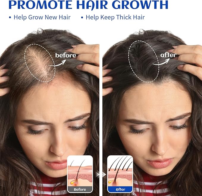 HIQILI Rosemary Oil for Hair Growth, Add to Shampoo & Conditioner - 16 Fl Oz