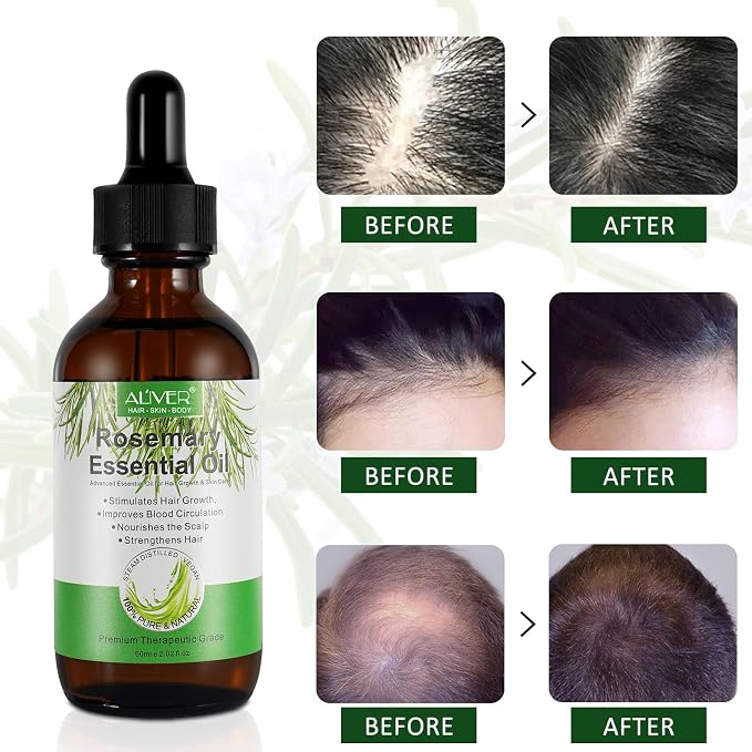 NIFEISHI Rosemary Oil for Hair Growth, 100% Pure Organic Rosemary Oil for Eyebrow and Eyelash, Nourishes The Scalp, Improves Blood Circulation,Rid of Itchy & Dry Scalp, Hair Care Oil 60ml
