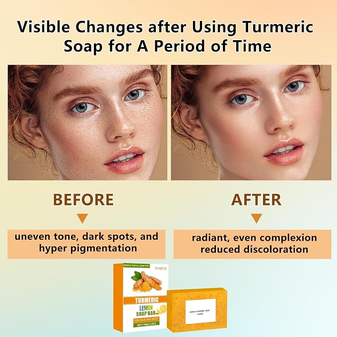Turmeric Soap Bar - Handmade Lemon & Ginger Soap Bar, 100% Natural Brightening for Dull Skin, Antioxidant Face & Body Soap, Outdoor Home Use, Fit All Skin Type 4.1 oz