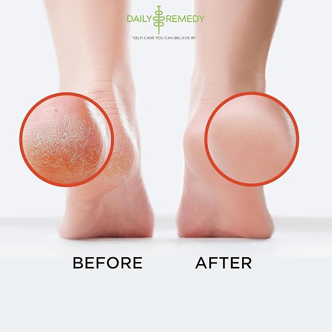 Muscle Relief Foot Soak with Epsom Salt, Made in USA, Soothe Tired Feet, Softens Calluses and Helps Athletes Foot 1lbs