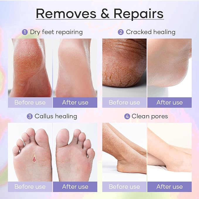 Deluxe Pedicure 6 Step in 1 Box – Epsom Salt, Callus Remover, Extreme Sugar Scrub, Collagen Mask, Massage Oil Candle & Shea Butter Lotion. (Orange 03 Set)