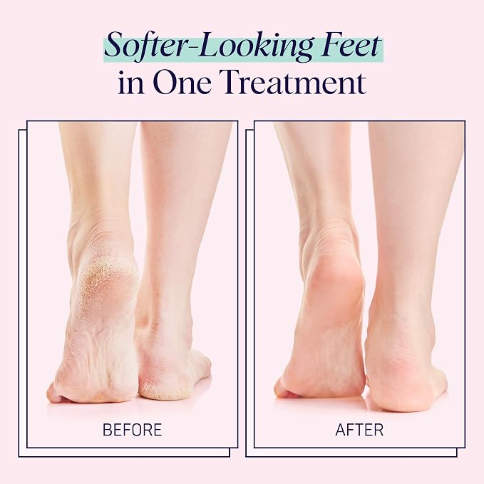 SpaLife Moisturizing Hand Gloves & Foot Mask Socks | Korean Skincare Set for Dry Cracked Hands & Dry Cracked Feet Callus Remover Alternative | Self Care Gifts for Women | 4 Hand, 4 Foot