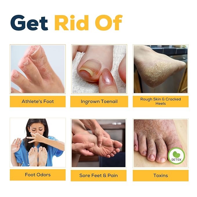 FOOT CURE Citrus Detox Foot Soak with Epsom Salts – for Foot Callus, Damaged Toenail Appearance, Pedicure Spa, and Soothing Sore, Tired Feet - 16 oz (Pack of 1)