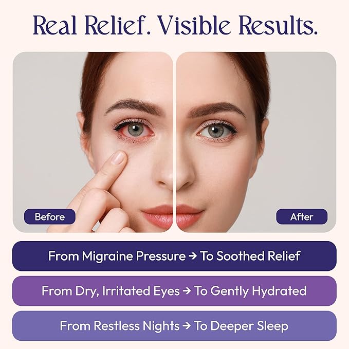 Fomin Steam Eye Mask - 20 Pack - Lavender - Self Heating Warm Compress for Dry Eyes, Puffy Eyes & Dark Circles, Disposable Sleep Mask for Home, Spa, Travel Essentials & Relaxation Gifts for Women