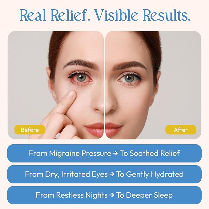 Fomin Steam Eye Mask - 20 Pack - Chamomile - Self Heating Warm Compress for Dry Eyes, Puffy Eyes & Dark Circles, Disposable Sleep Mask for Home, Spa, Travel Essentials & Relaxation Gifts for Women