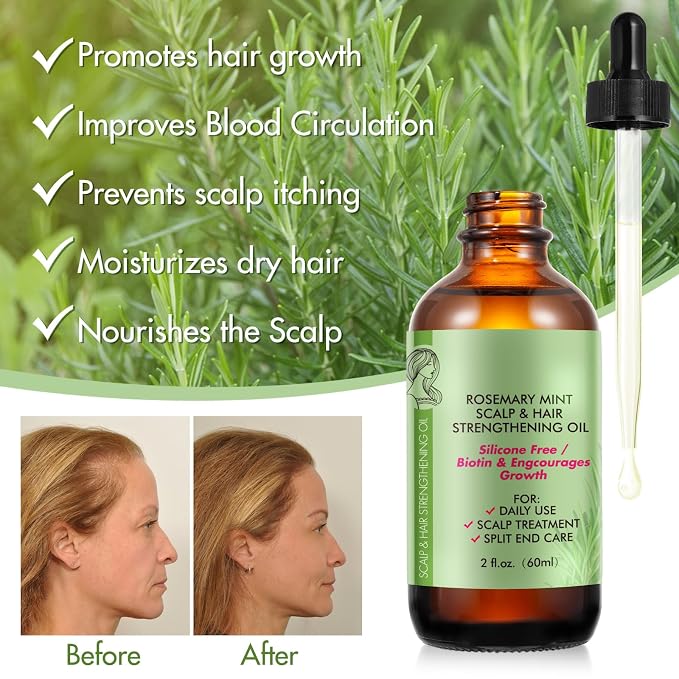 Rosemary Oil for Hair Growth, Rosemary Essential Oil, 100% Pure Natural, Dry Scalp Treatment, Hair Growth Serum for Thicker Longer Fuller Healthier Hair 2.02 fl oz