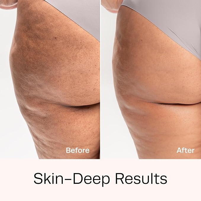 Hot Vita Retinol Toner – Roll-On Oil with Retinol for Smoother, Firmer-Looking Skin – Targeted Care for Belly, Thighs, Arms & Legs – Helps Improve Texture and Appearance