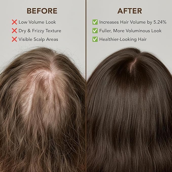 Botanic Hearth Batana Oil for Hair Growth & Hair Treatment Oils 4 Fl Oz | Dr Sebi Inspired, 100% Raw & Pure Batana Oil | Scalp & Hair Treatment for Thickness & Strength | All Hair Types