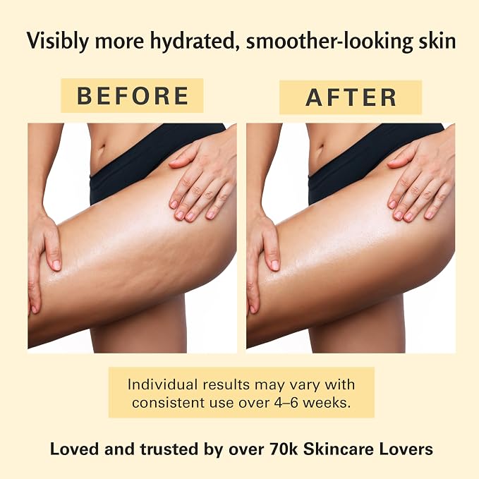 Firming Body Massage Oil with Collagen & Stem Cell – Helps Smooth the Appearance of Cellulite & Improve Skin Texture – Refreshing Aromatherapy Body Oil for Legs & Full Body – 8 Fl Oz by M3