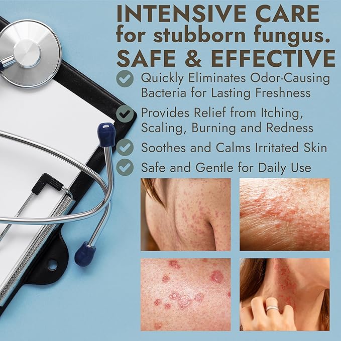 Antifungal Body Cream for Ringworm & Athlete’s Foot | Strength Formula with Tea Tree Oil | Helps With Itching, Burning & Scaling Relief | Treatment For Skin Fungus | 4.05 fl oz