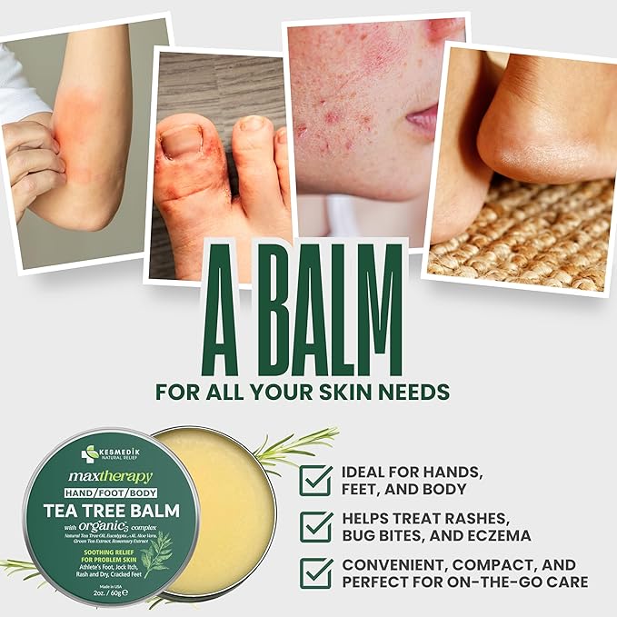 KESMEDIK Tea Tree Oil Balm for Skin, Soothes Itching, Rashes & Dry Skin, Antifungal Defense for Athlete’s Foot, Jock Itch, Chafing, Bug Bites & Eczema, Natural, Effective & Safe for All Ages