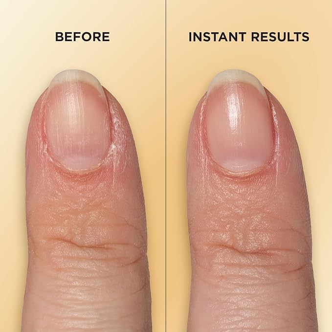 Sally Hansen Vitamin E Nail & Cuticle Treatment Pen | Hydrates and Conditions Dry Nails | Nourishing Formula with Apricot Oil | Smooth, Healthy-Looking Nails | Easy, Mess-Free Nail Care on the Go