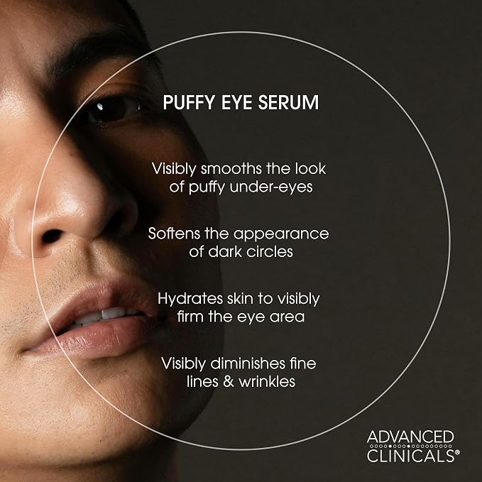 Advanced Clinicals Puffy Eye Under Eye Serum | Visible Anti Aging Brightening Vitamin C + Caffeine Serum Helps Improve Look Of Puffiness, Fine Lines, Dark Circles, & Uneven Skin Tone, 1.75 Fl Oz