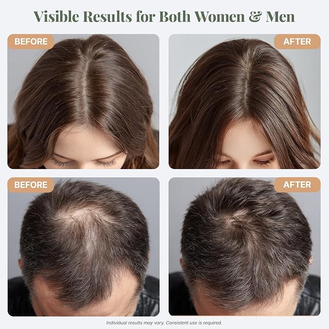 The ÉLIX USDA Organic Rosemary Oil for Hair Growth | Thickening Formula with Castor & Pumpkin Seed | for Hair Loss & Thinning | Made in USA | 4oz