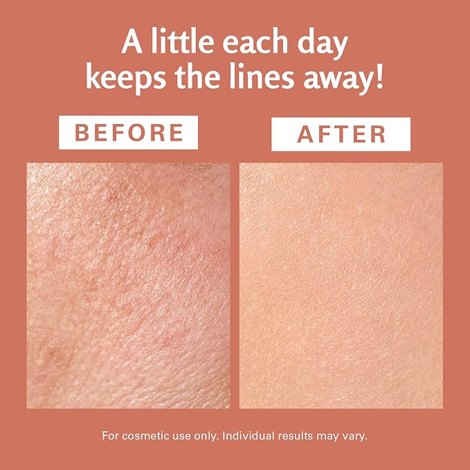 Frankincense Essential Massage Oil for Scars, Stretch Marks & Fine Lines, Firming, Hydrating, Smoothing & Calming Formula with Collagen, Stem Cells, Lavender & Grapefruit, 8 fl oz, by M3