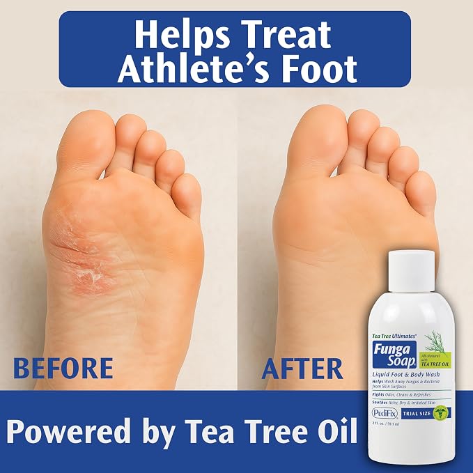 Pedifix FungaSoap® Tea Tree Oil Foot & Body Wash – 2 oz (Travel Size) – Small Bottle for Itchy Skin, Odor & Fungus Care – Perfect for On-the-Go Use – Same Formula as Larger Sizes